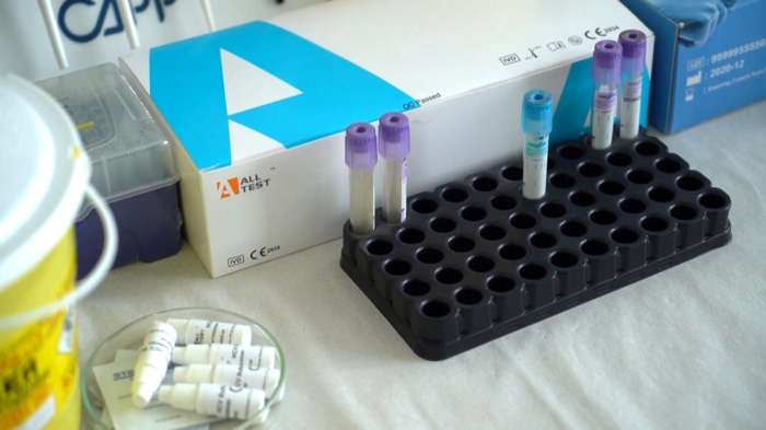 С диагнозата ХИВ: 19-годишен е третия позитивен в Монтанско 